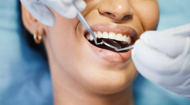 Best Urgent Care for Lost Fillings or Crowns in Lyford, TX