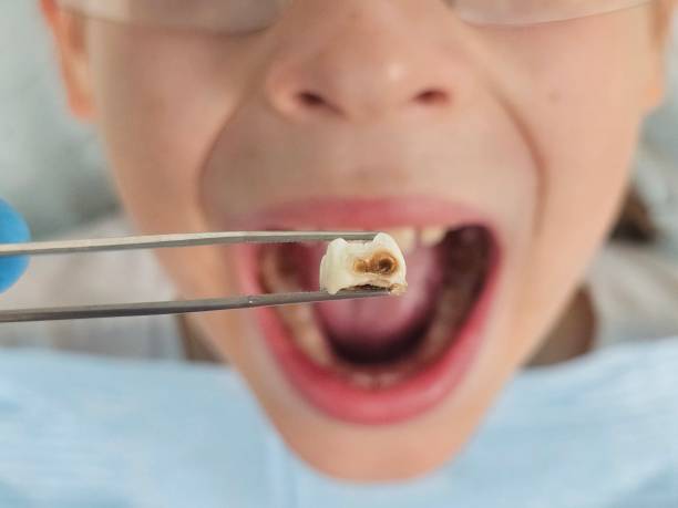 Best Emergency Gum Treatment in Lyford, TX